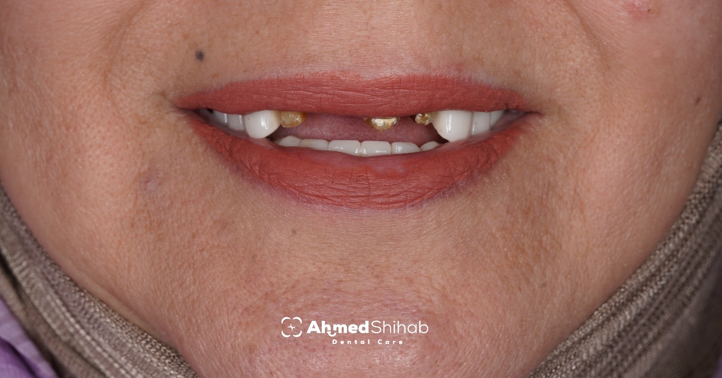 حالة تجميلية - قبل